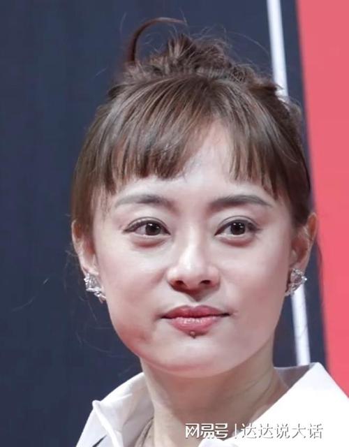 新澳天天开奖资料大全一和孙俪唇下痣没了与孙俪嘴唇的痣